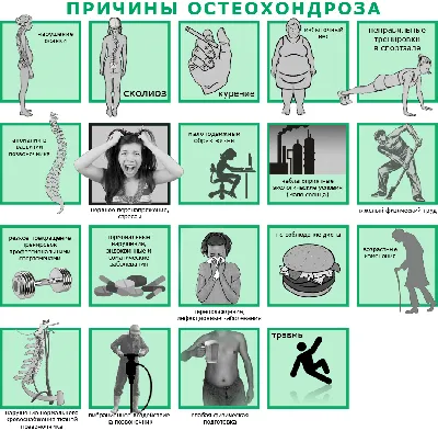 Упражнения при шейном остеохондрозе: лечебная гимнастика, ЛФК и эффективная  зарядка дома