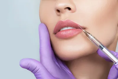 Контурная пластика губ — что нужно знать о процедуре