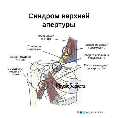 Модель верхней конечности человека с поверхностными и глубокими  кровеносными сосудами (раздел «Терапия») | Купить учебное оборудование по  доступным ценам в ПО «Зарница»