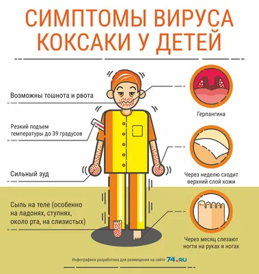 Что такое вирус Коксаки: симптомы, профилактика, лечение - 18 августа 2017  - 72.ру