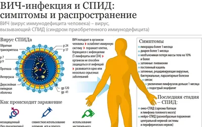 Что такое ВИЧ-инфекция и СПИД