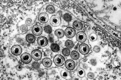 Клініка Медіком - Скільки живуть віруси поза організмом... | Facebook