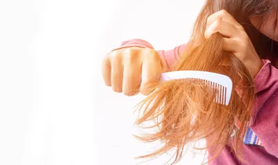 Выпадение волос после коронавируса: что делать и чем лечить? – Публикации –  Лаборатория Ан-Тек