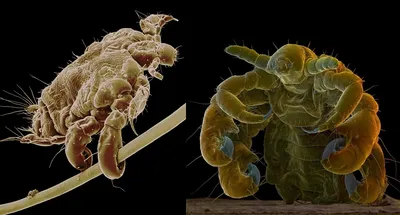 Как выглядят гниды — фото на волосах, яйца вшей под микроскопом