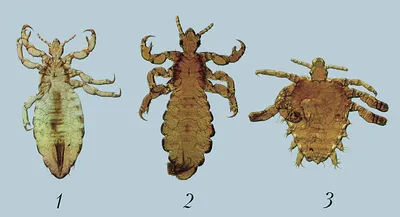 Лобковая вошь под микроскопом | Пикабу