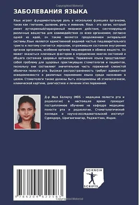 Налет на языке - причины появления, при каких заболеваниях возникает,  диагностика и способы лечения