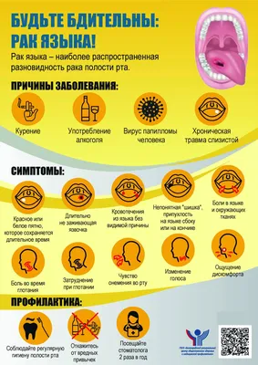 Заболевание Языка Пероральный Дрозд Кандидоз Инфекционное Заболевание  Внутреннего Рта Грибковое стоковое фото ©lightsource 198407428