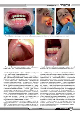 Воспаление во рту: диагностика, схема лечение. Чем полоскать?