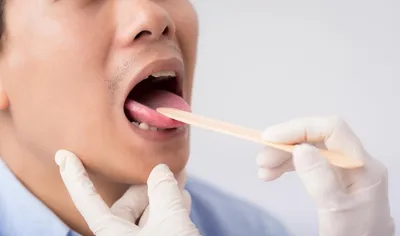 Посетите стоматолога, чтобы исключить онкологическое заболевания полости рта  | РКБ г. Реутов
