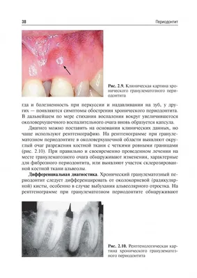 Заболевания полости рта: классификация, лечение, профилактика –  Стоматология в Бирюлево
