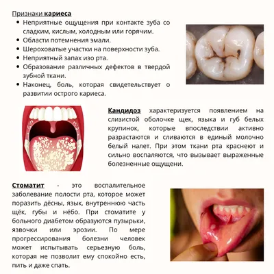 Ирина Макеева: «Хроническое воспаление в полости рта может привести к  ишемической болезни сердца»