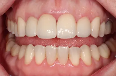 Заболевания слизистой полости рта: виды и особенности лечения