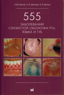 Ужас во рту. Что делать!? СТОМАТИТ, ПАРАДОНТОЗ, ТЕРПЕС И ДРУГИЕ ЗАБОЛЕВАНИЯ  ПОЛОСТИ РТА | Школа Здоровья Натальи Кондаковой | Дзен