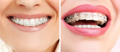 здоровые зубы стоковое фото. изображение насчитывающей обслуживание -  16991574