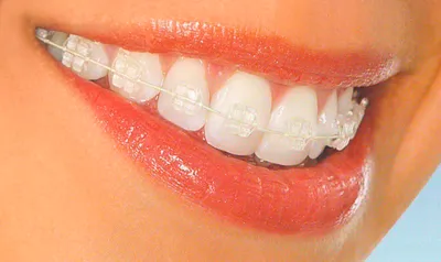 Приветствую всех посетителей стоматологической клиники “Здоровые зубы”! -  Стоматология Здоровые Зубы