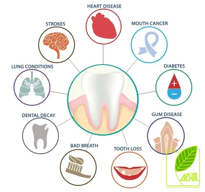 Здоровые зубы залог хорошего здоровья - Karkent Hambaravi