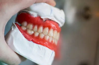 Красивые зубы-здоровые зубы... - Красивые зубы-здоровые зубы