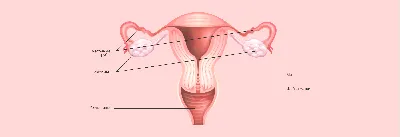 Человеческая Женская матка, ячейное заболевание, диссекационная патология,  модель женской матки, анатомия, Лечение матки D5QC | AliExpress