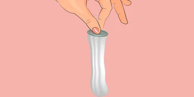 Женские презервативы – какие существуют преимущества - Здоровье 24