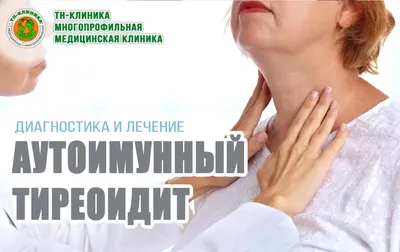 Диффузный зоб щитовидной железы - лечение в Ростове-на-Дону