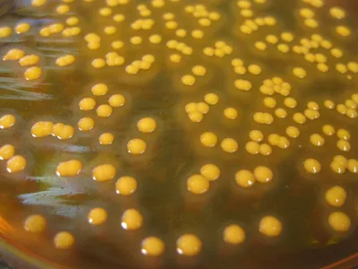 Золотистый стафилококк – Staphylococcus aureus – Бакпосев.Ру