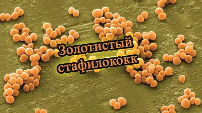 Бактерии золотистого стафилококка Иллюстрация штока - иллюстрации  насчитывающей иллюстрация, здоровье: 86572827