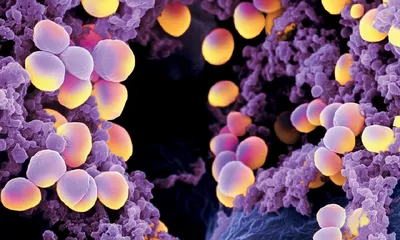 Опасные микроорганизмы: Золотистый Стафилококк | ИНТЕРСЭН-плюс | Дзен