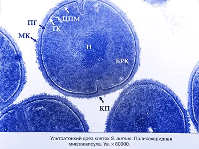 Диагностика стафилококка, симптоматика и лечение инфекции - ТОВ «Бiокор  Текнолоджi ЛТД»