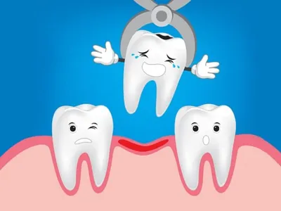 Болит зуб при надавливании или надкусывании — причины, симптомы, методы  лечения