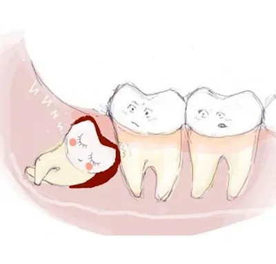 Трещины на зубах - причины, симптомы, диагностика, лечение