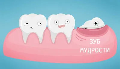 Удаление зуба – цена в Москве | Стоимость удаления зубов в стоматологии  Vimontale