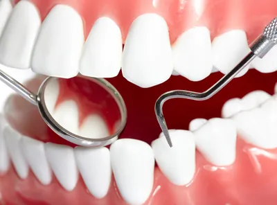 Мертвый зуб: может болеть, лечить или удалять?
