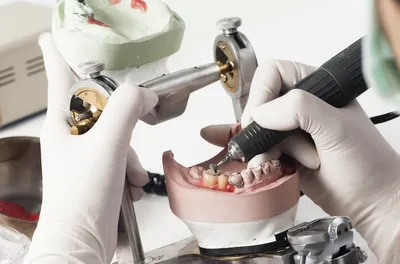 Все о профессии зубного техника