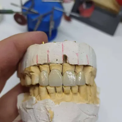 С Днем зубного техника!