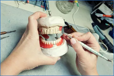 Профессия зубного техника: настоящее и будущее :: РотФронт –  зуботехническая лаборатория в Санкт-Петербурге +7 (962) 714-8175