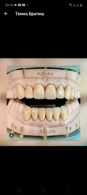 зубной техник зажимает оттиски вместе Фото Фон И картинка для бесплатной  загрузки - Pngtree