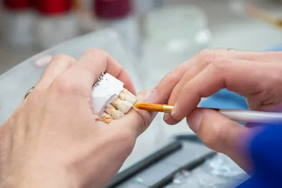 Какой информацией зубной техник поможет ортопеду? :: РотФронт –  зуботехническая лаборатория в Санкт-Петербурге +7 (962) 714-8175