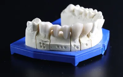 Изготовление зубных протезов зубной техник фиксирует протез | Премиум Фото