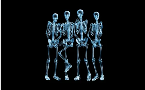 Медицинские Обои на телефон группа человеческих скелетов