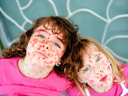 Краснуха Фото пара девушек с краской на лицах
