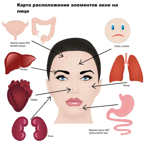 Гормональные Прыщи Фото в высоком качестве