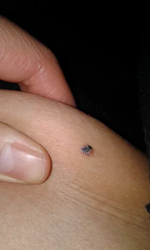 Базалиома Фото маленькое насекомое на пальце человека