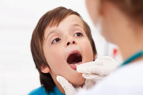 Гнойная Ангина Фото стоматолог осматривает зубы ребенка