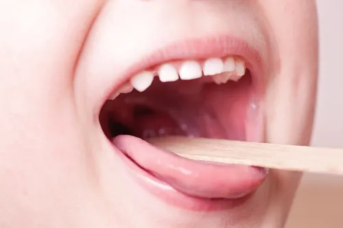 Гнойная Ангина Фото рот человека с зубной щеткой