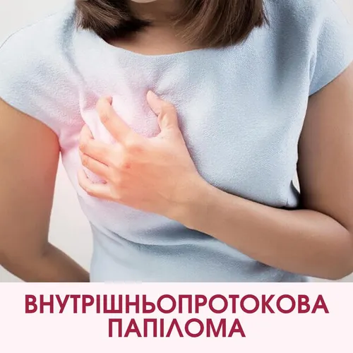 Злокачественные Папилломы Фото женщина с руками на груди