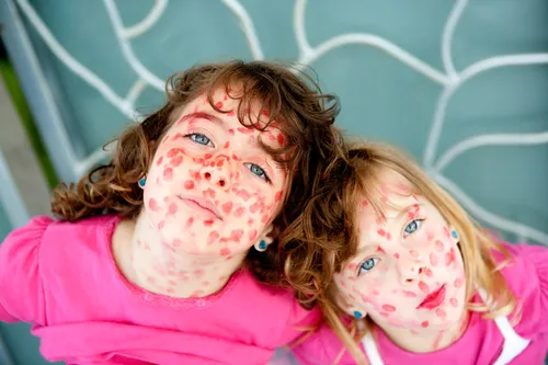 Корь Фото пара девушек с краской на лицах