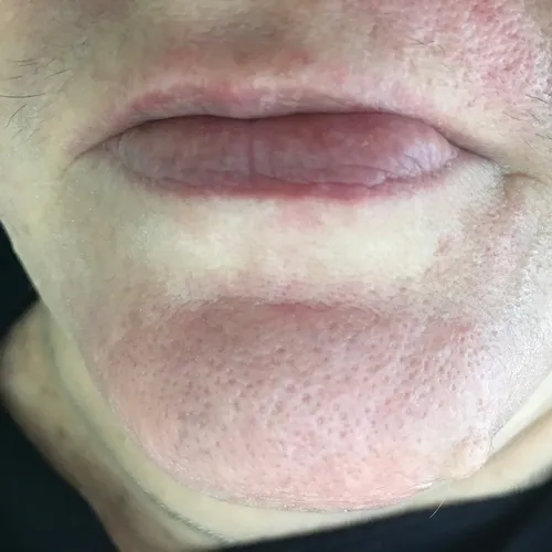 Нервные Пятна На Коже Фото крупный план губ человека