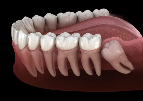 Зуб Мудрости Фото крупный план человеческой кости