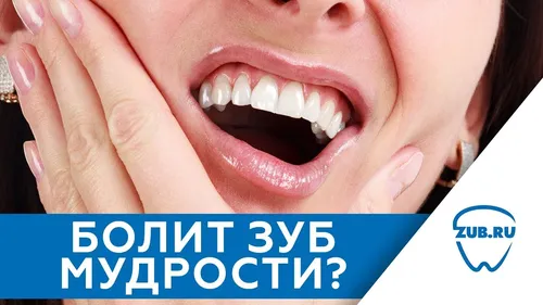 Зуб Мудрости Фото крупный план смеющейся женщины