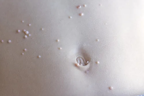 Контагиозный Моллюск Фото маленькое животное в воде